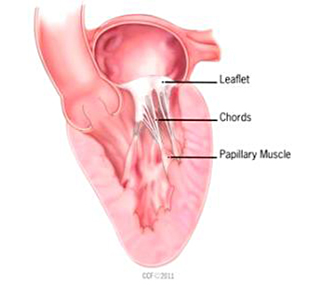 Mitral Valve Chordae and Papillary Muscles