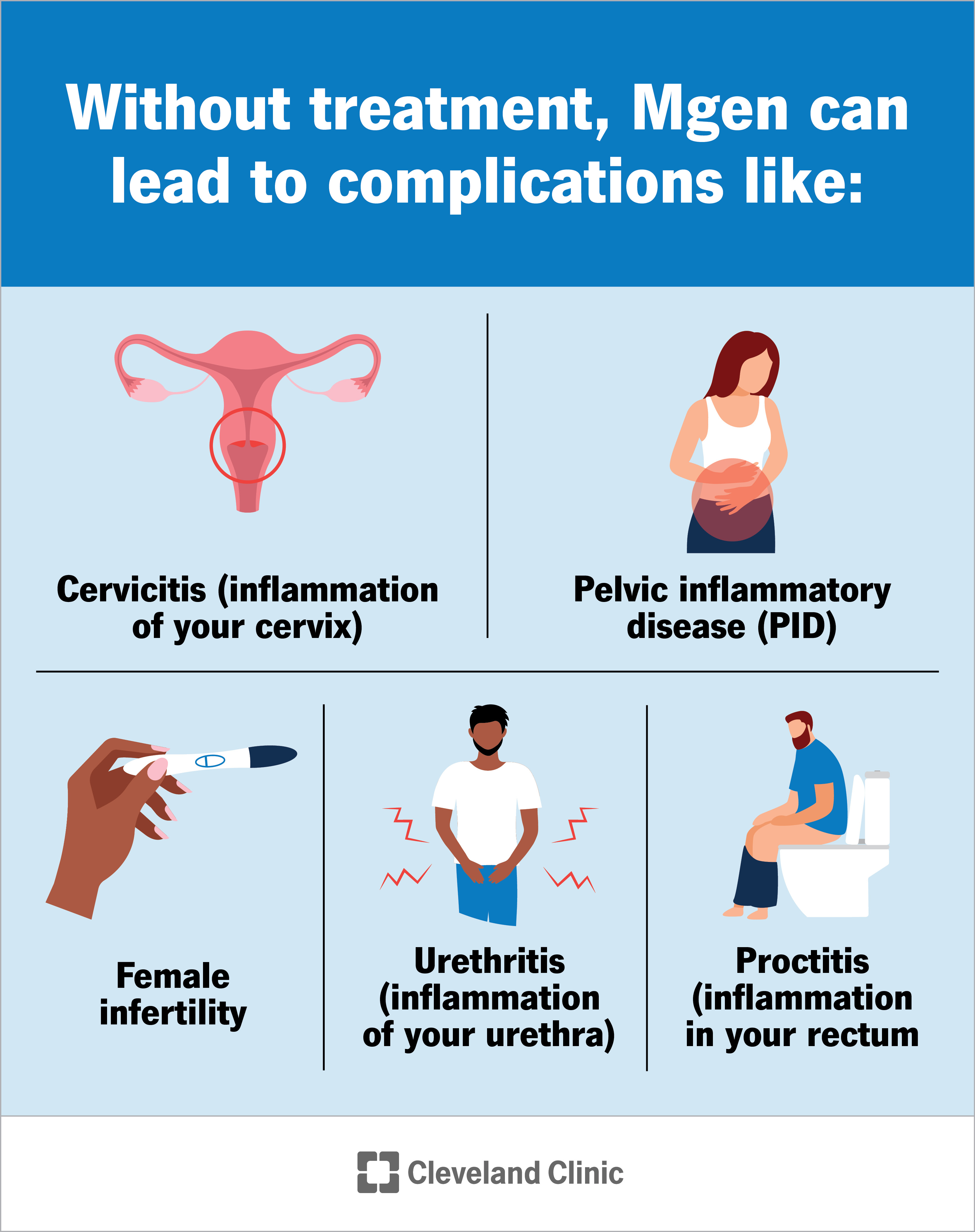 Without treatment, Mgen can lead to complications like cervicitis, infertility, pelvic inflammatory disease and urethritis