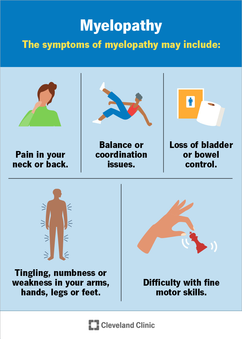 Common symptoms of myelopathy, including loss of bladder control, pain in your neck or back and balance issues