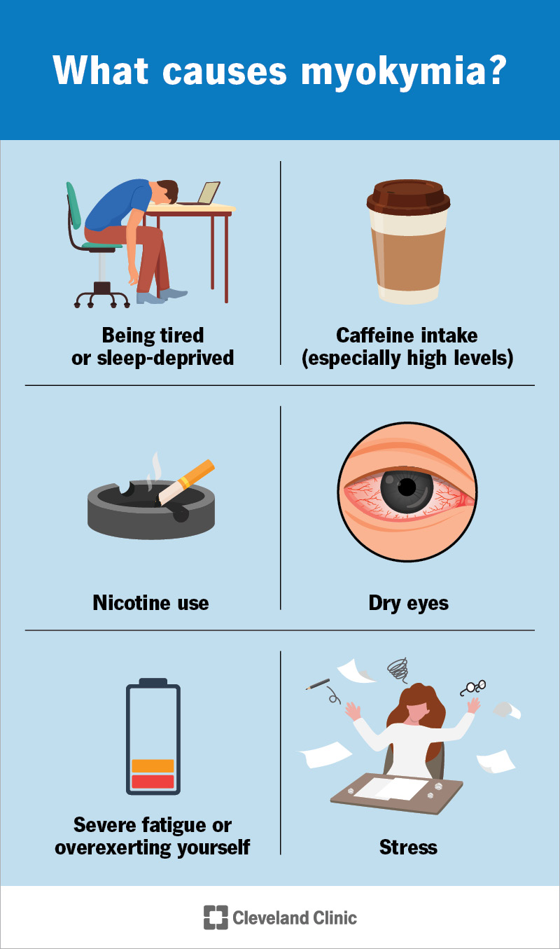 Myokymia, muscle twitching around your eyes, is common, especially when you’re under stress or take in caffeine or nicotine