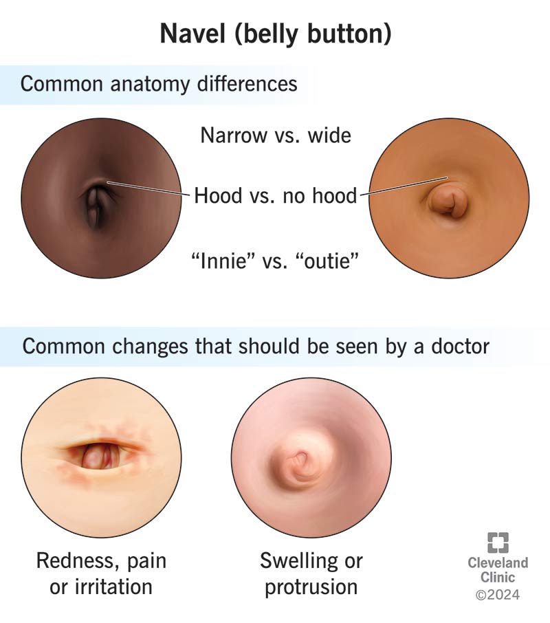 Navel Belly Button Anatomy Types