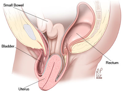 obgyn-uterine-prolapse.ashx?la=en&hash=A