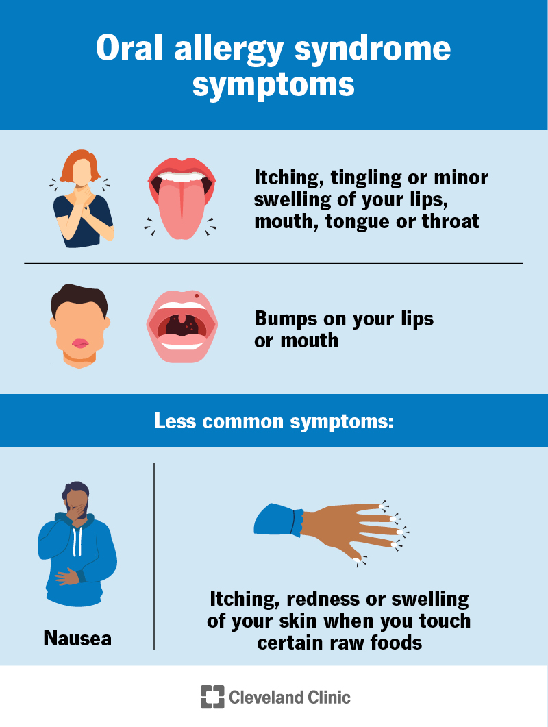 Oral allergy syndrome usually causes itching, tingling or minor swelling of your lips, mouth, tongue or throat
