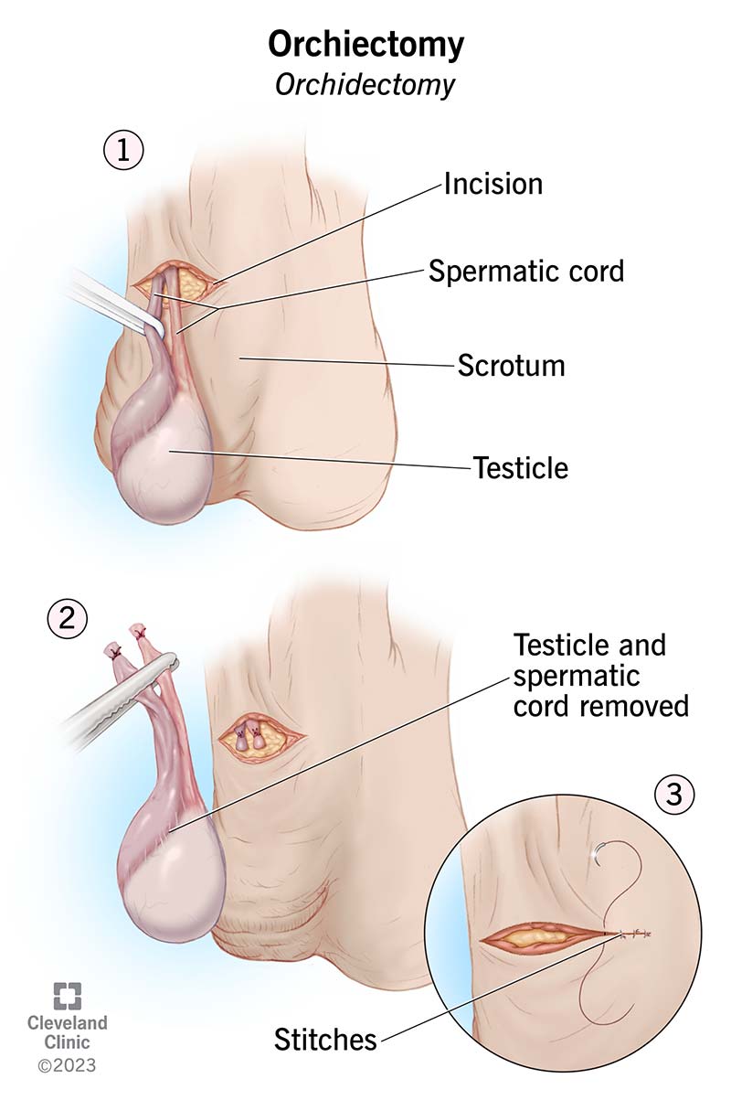 3 reasons why your testicles have become bigger