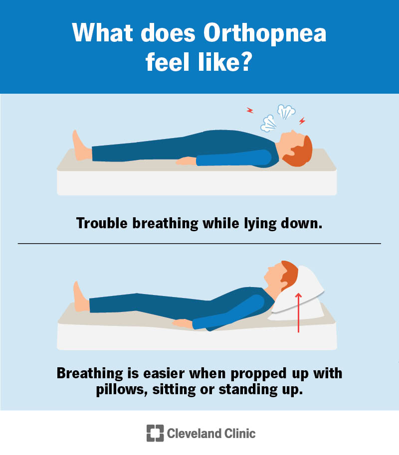 A person with orthopnea is short of breath when lying down. Adding pillows under his head makes it easier for him to breathe.