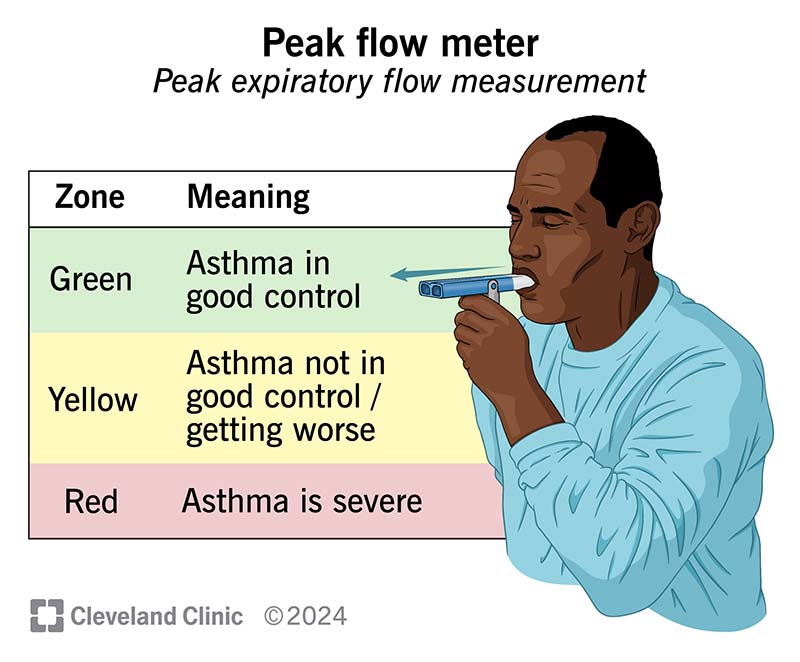 A peak flow meter uses a traffic light system. Green is good, yellow means your flow is worsening and red is an emergency.