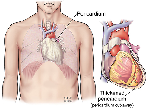 Sharp pain around heart