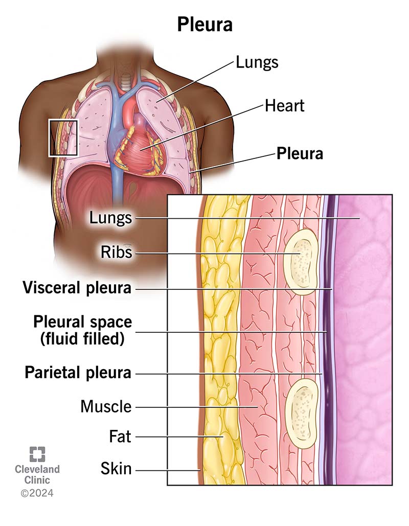 The pleura has two layers. The visceral pleura covers your lungs, and the parietal pleura attaches to your chest wall.