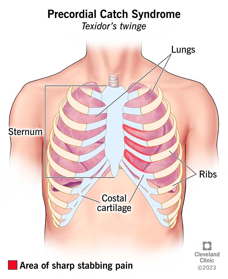 Sharp Pain Under Left Rib, A heart attack is rarely the cause of