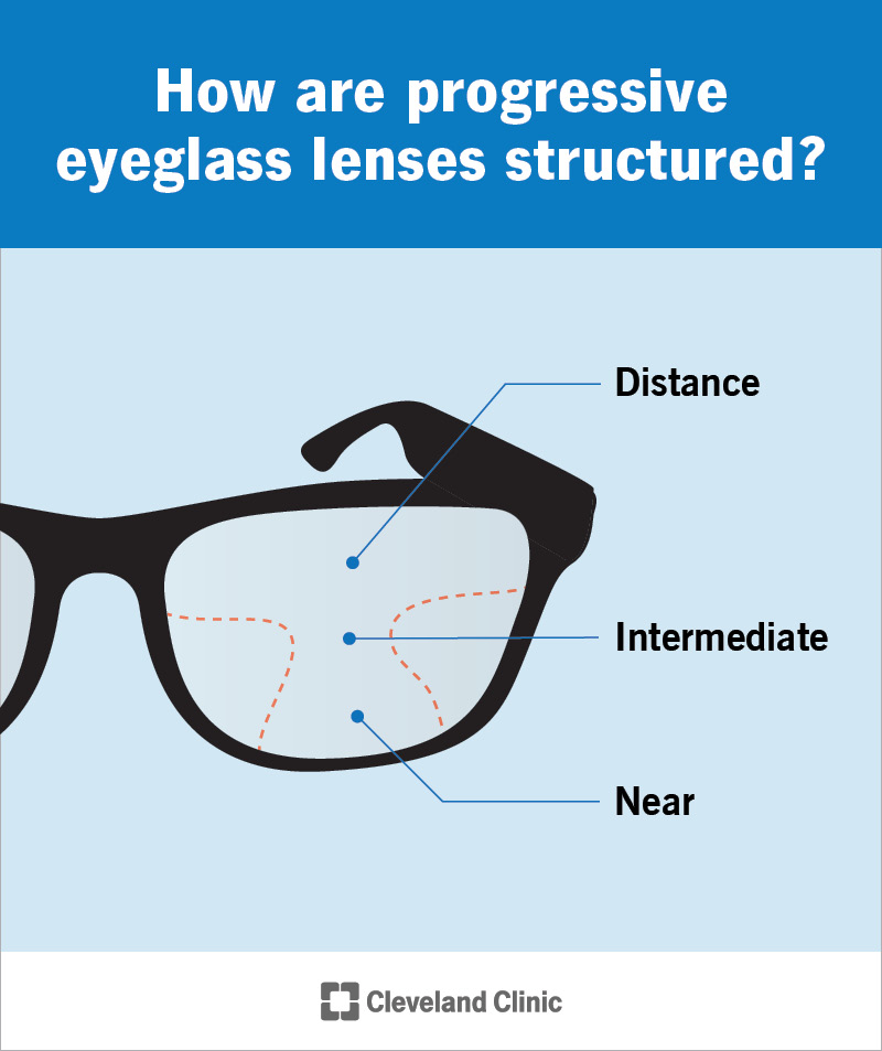 The top of a progressive lens is best for seeing distance, while the bottom of the lens is best for seeing up close.