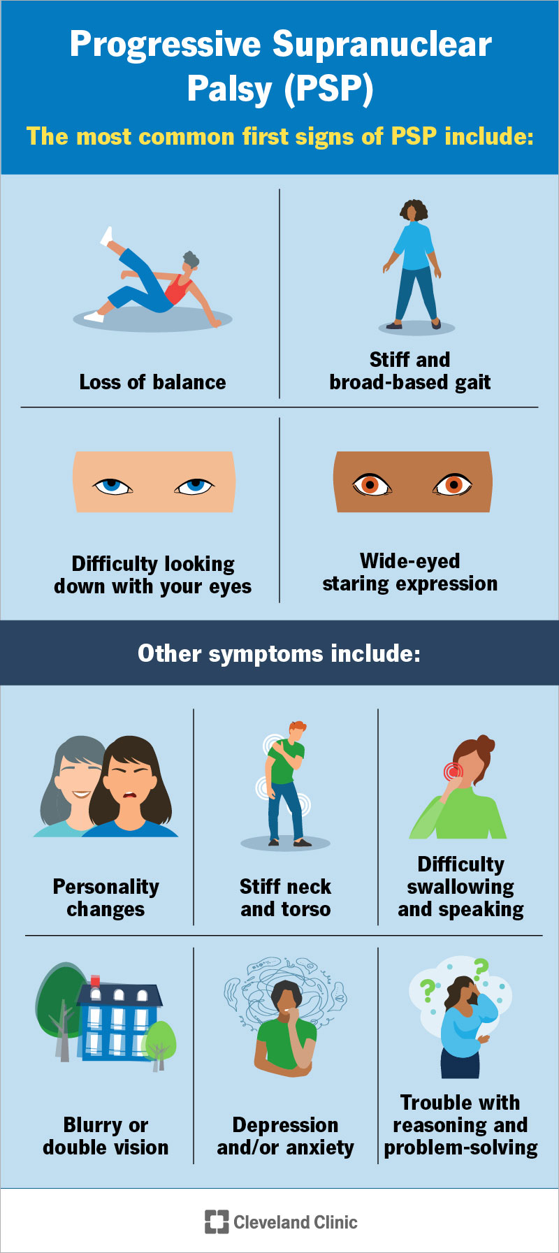 Common first signs of PSP include loss of balance, broad and stiff gait, trouble looking down and wide-eyed stare