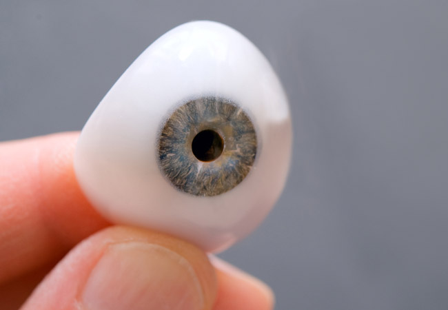 Prosthetic eyes are wearable medical items that look like and take the place of eye tissue you lost or were born without