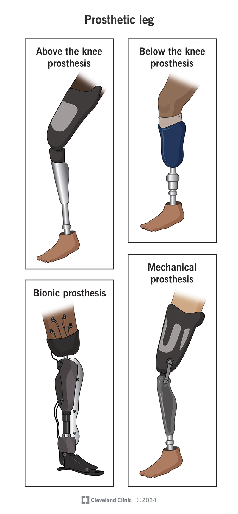 Illustration showing different types of prosthetic legs.