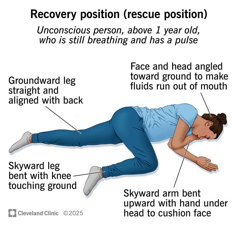 The rescue position can help people over 1 year old who are unconscious but still breathing, and have a pulse