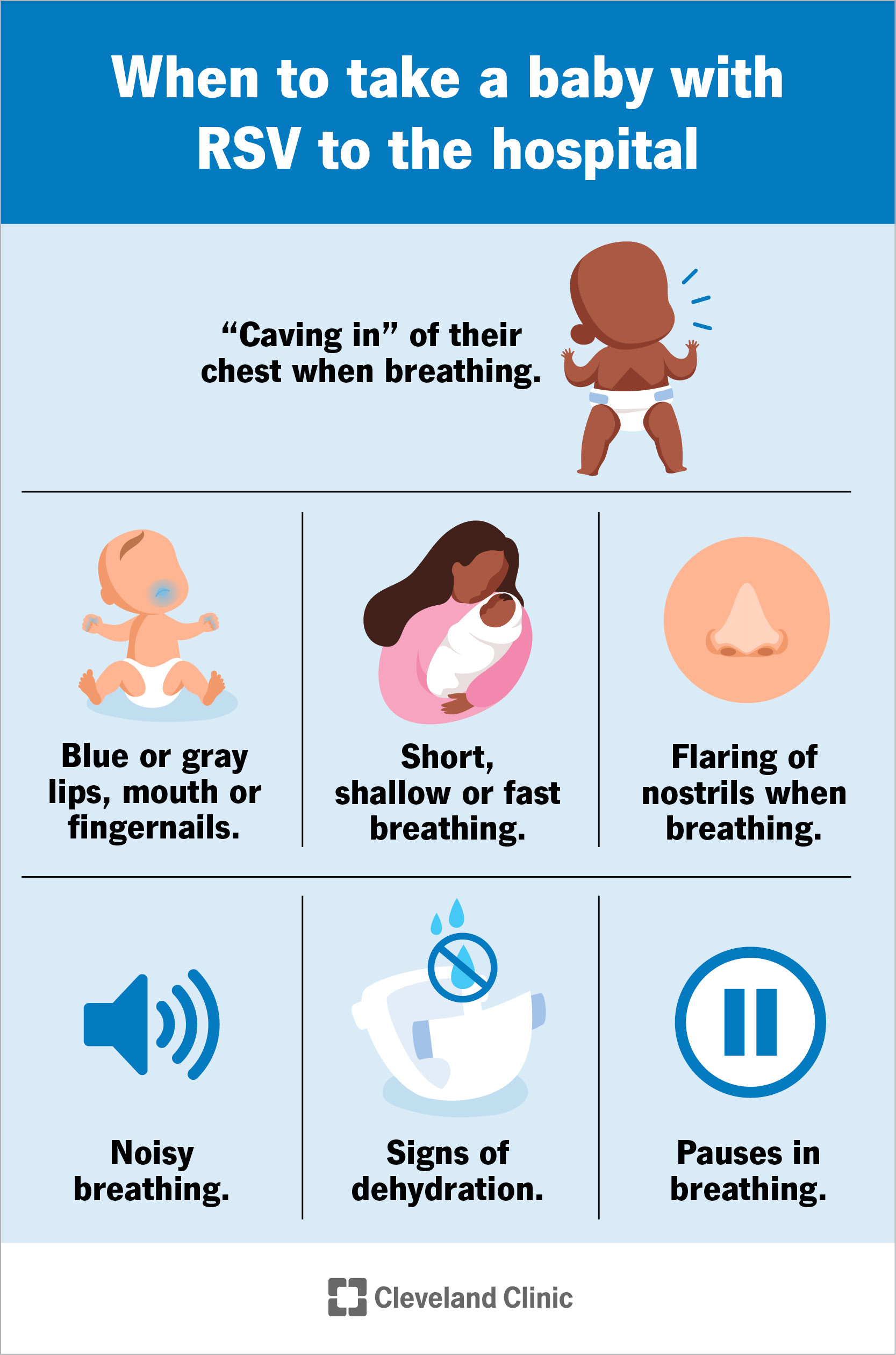 Babies with severe RSV symptoms, like changes to their breathing, need care at a hospital.