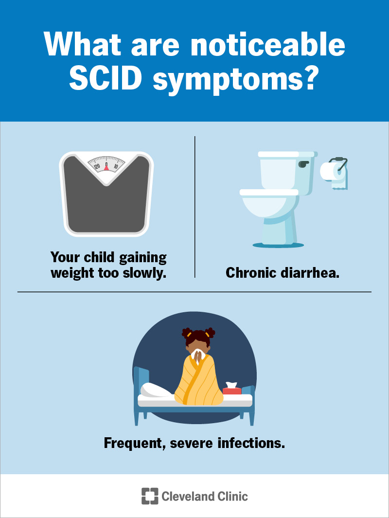 Severe combined immunodeficiency may not cause many symptoms you can notice.