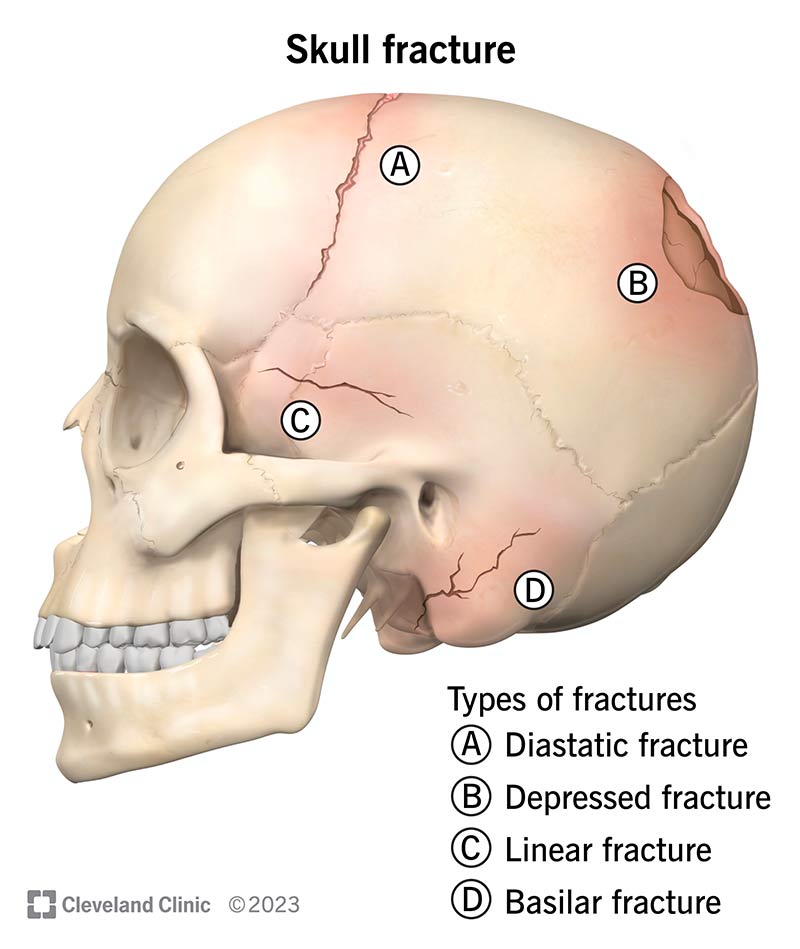 Skull Bone Anatomy & Clinical Significances - Anatomy Info