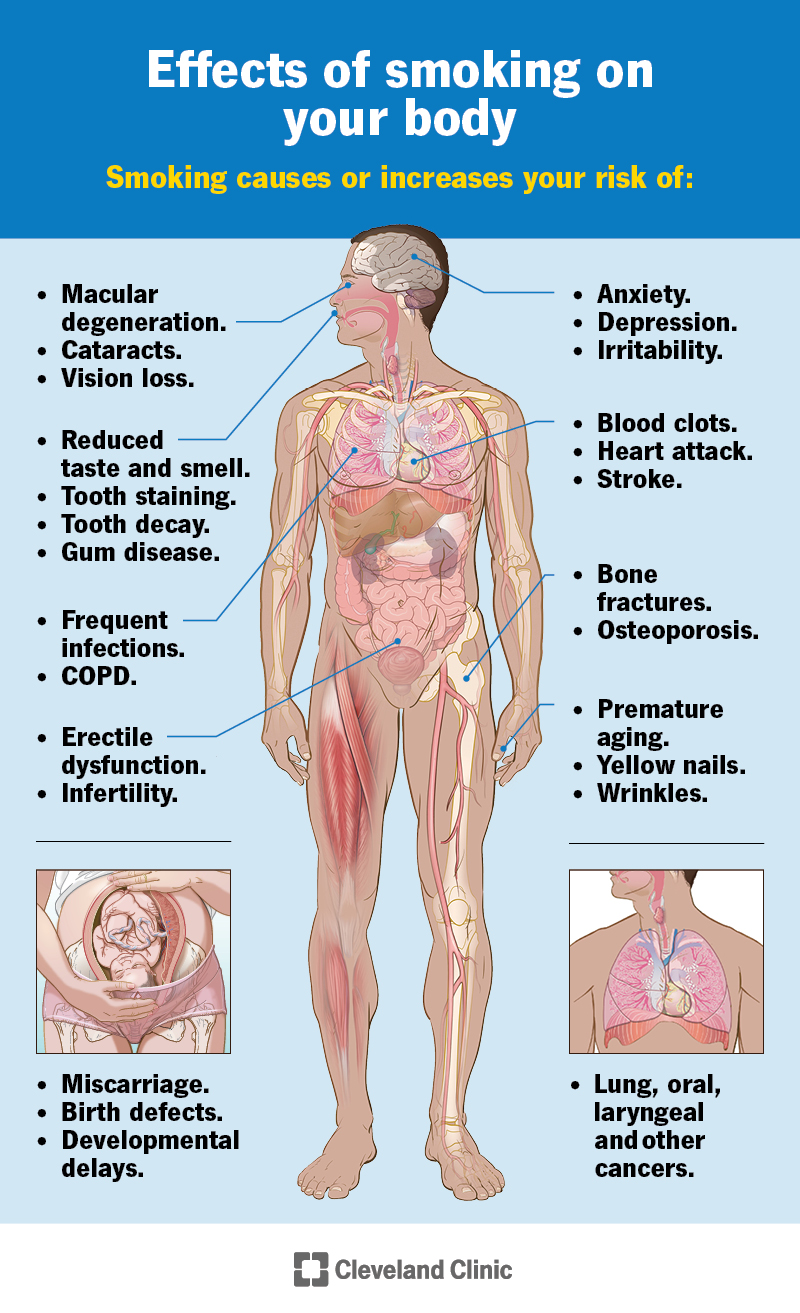 Smoking Effects Risks Diseases Quitting Solutions