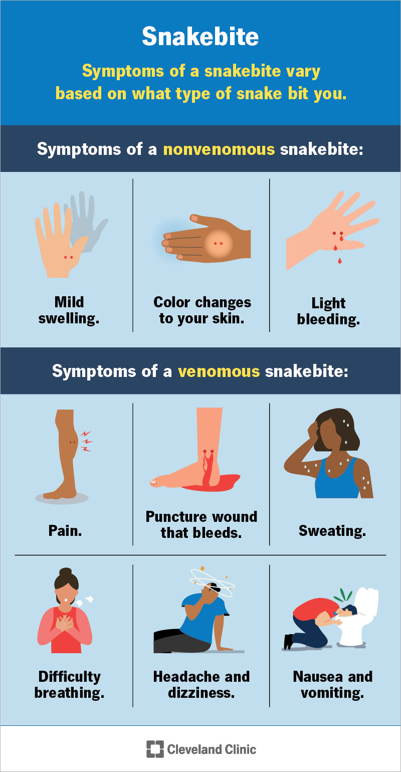 Symptoms of a nonvenomous snakebite and a venomous snakebite