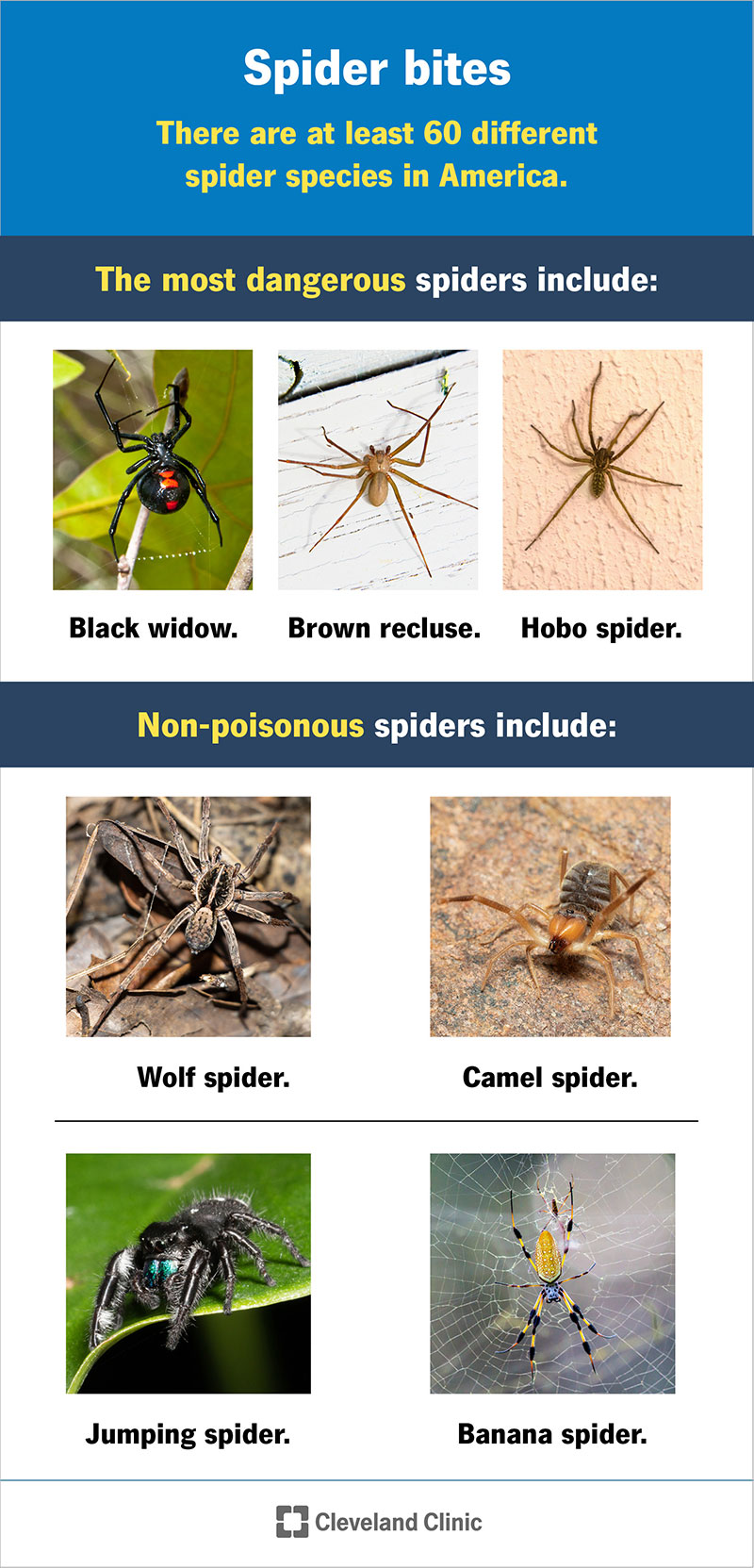 Black widows, brown recluses and hobo spiders are the most dangerous spiders in America