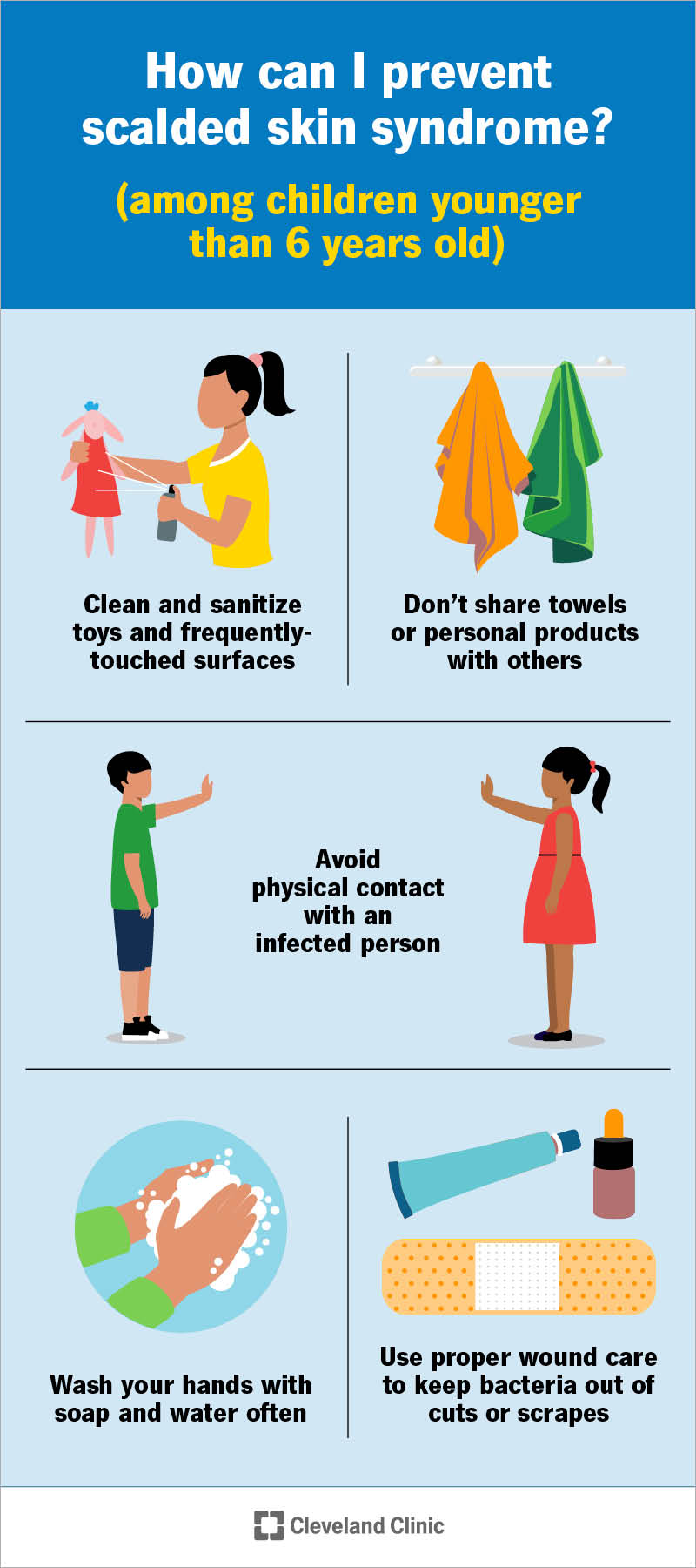 Scalded skin syndrome prevention in children revolves around stopping germs from spreading and preventing infections