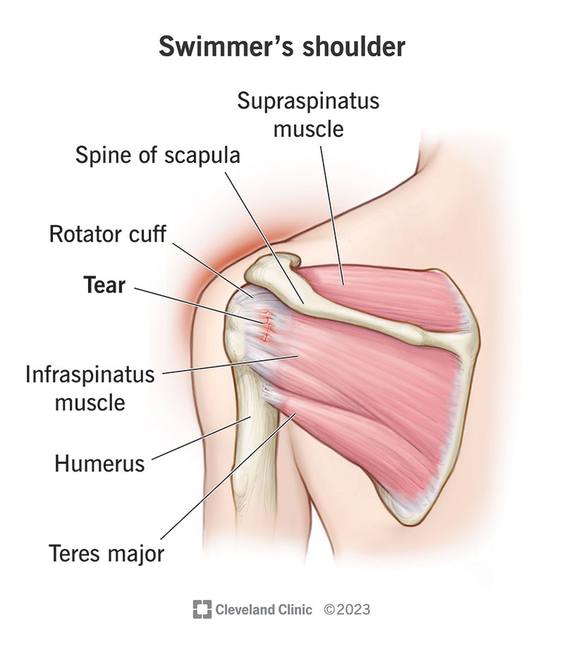 3. Shoulder Extension (End Range-Band) - End Position - Dr