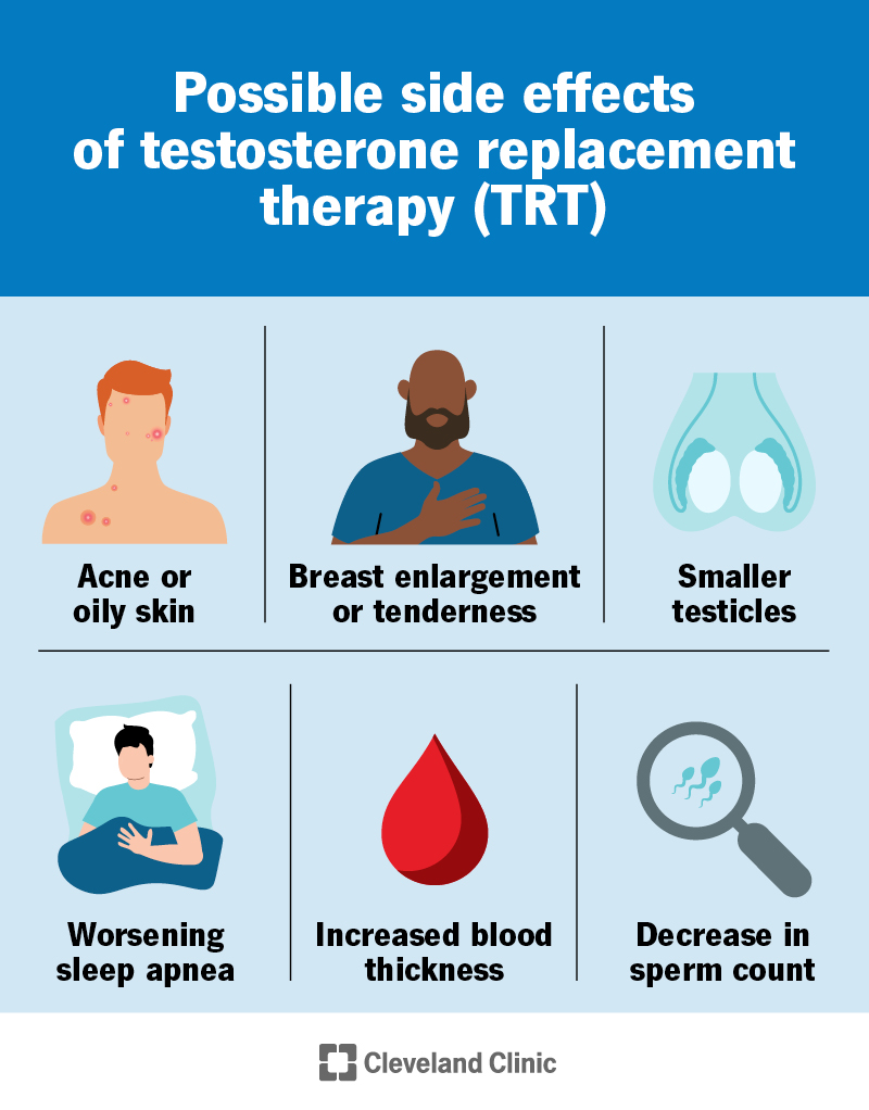 Side effects of TRT include acne, breast enlargement, smaller testicles, worsening sleep apnea, low sperm count and more