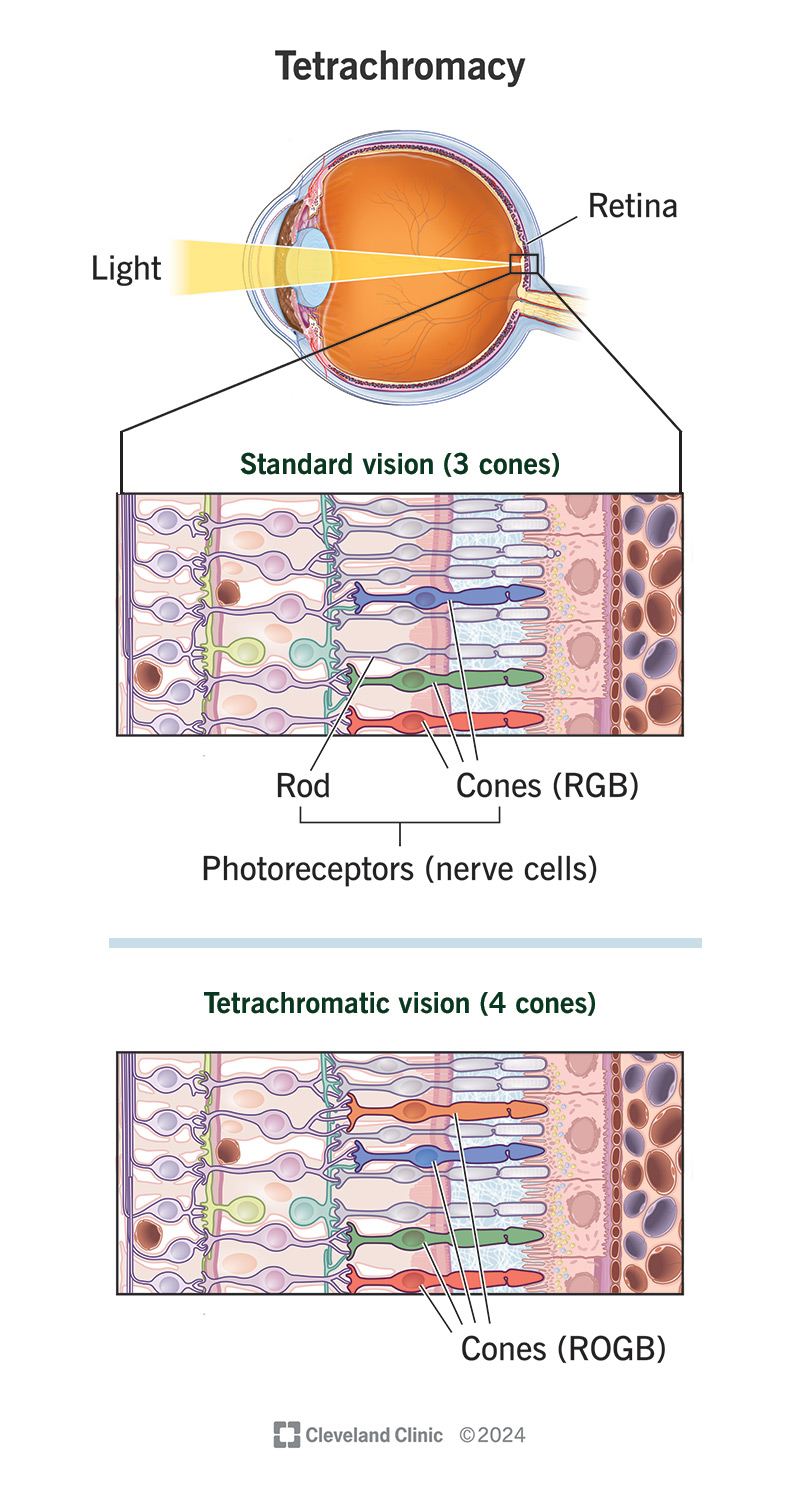 Tetrachromacy gives you an extra type of color-sensitive photoreceptors, sometimes granting exceptional color vision.