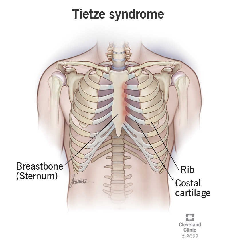 A rib cage with special attention to the costochondral junction of the first four ribs