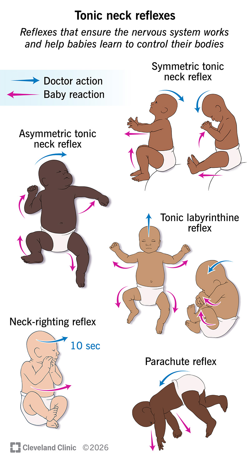 Tonic neck reflexes, including doctor movements of infant body parts and expected infant reflex reactions
