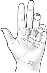 Trigger finger, when your fingers or thumb stick in a flexed position, in a person’s left hand.
