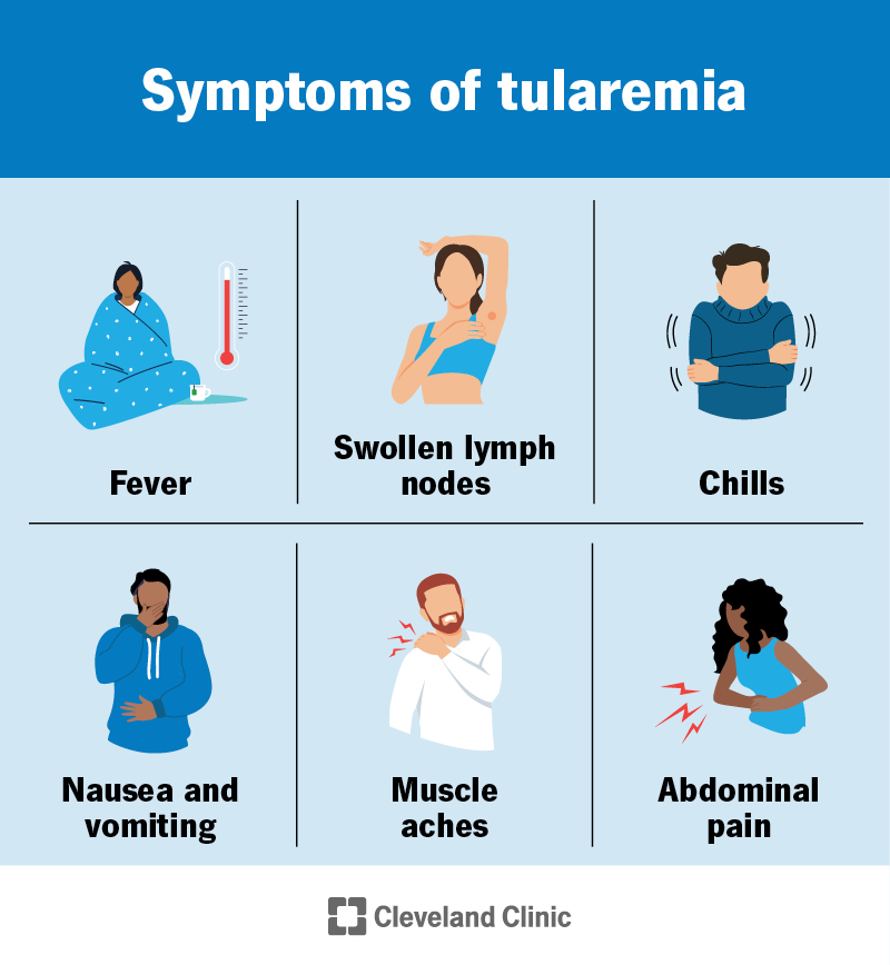 General tularemia symptoms include swollen lymph nodes, fever, chills, nausea, vomiting, muscle aches and abdominal pain