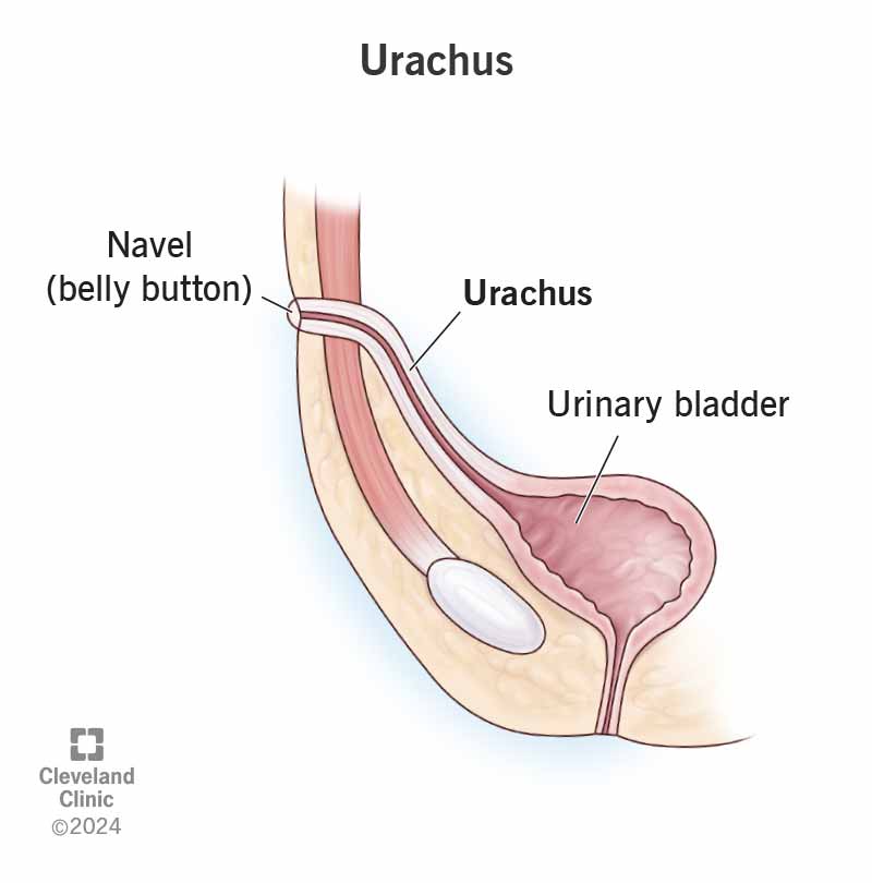 Illustration showing urachus connecting belly button to the bladder in a fetus.