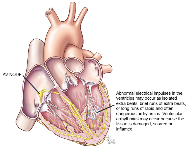 Image Credit: ClevelandClinic.org