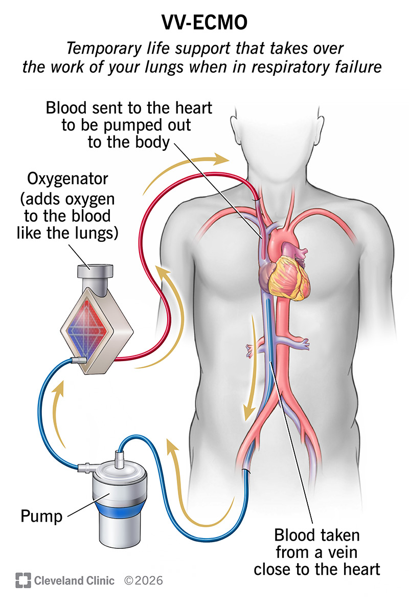 Anatomy of heart and major blood vessels with VV-ECMO pump and oxygenator