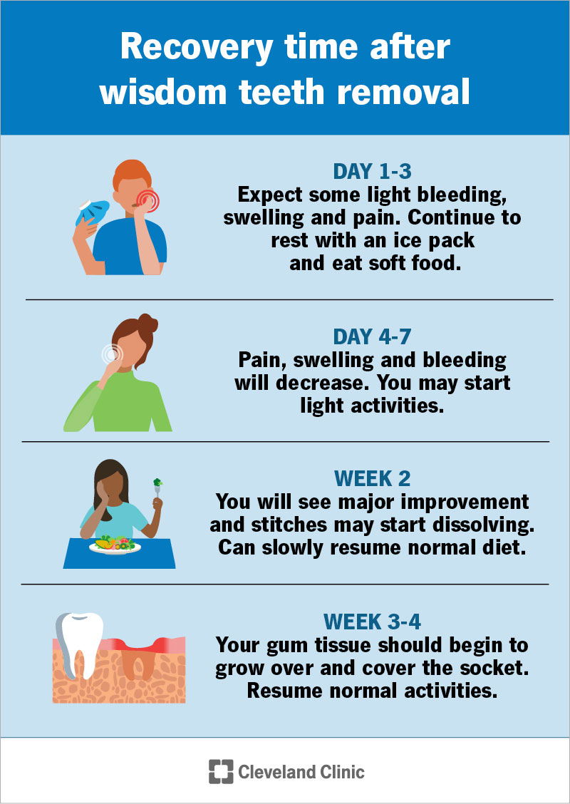 Recovery timeline and what to expect for wisdom teeth removal, from day 1 to week 4