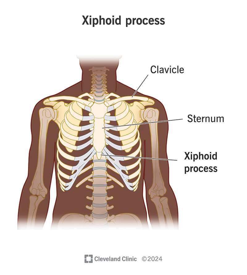 The xiphoid process is the pointed, lower section of your sternum (breastbone).