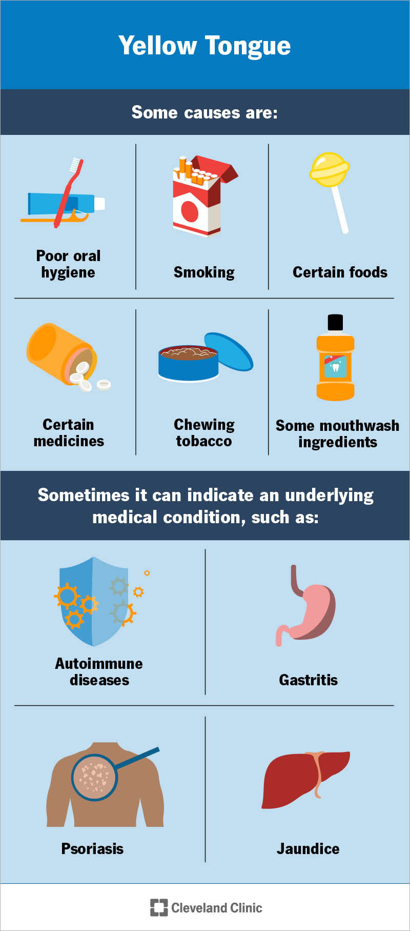 Causes and indications of yellow tongue