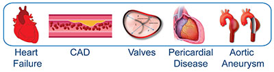 Cardio-rheumatology Types of Heart Conditions