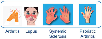 Cardio-Rheumatology Types of Conditions