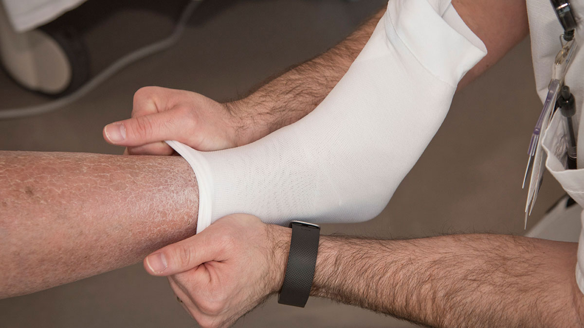 Compression stockings ineffective in treating Deep Vein Thrombosis