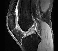 Musculoskeletal Imaging