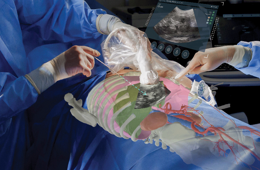 Augmented reality technology displays real-time ultrasound imaging to support precision during a minimally invasive procedure.