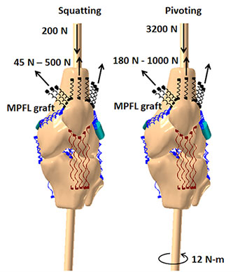 Image of computational models for simulation of knee function.