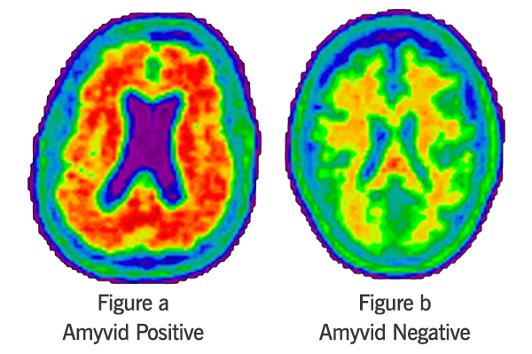 Scans | Cleveland Clinic Nevada