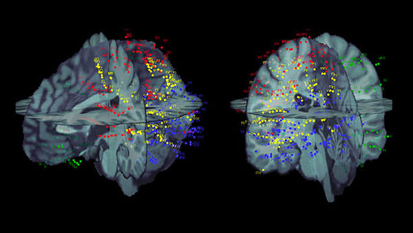 Epilepsy Fellowships