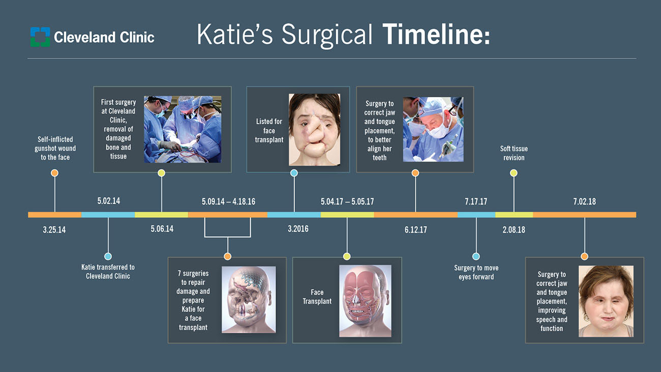 Katie endured more than 17 surgeries at Cleveland Clinic. (Courtesy: Cleveland Clinic)