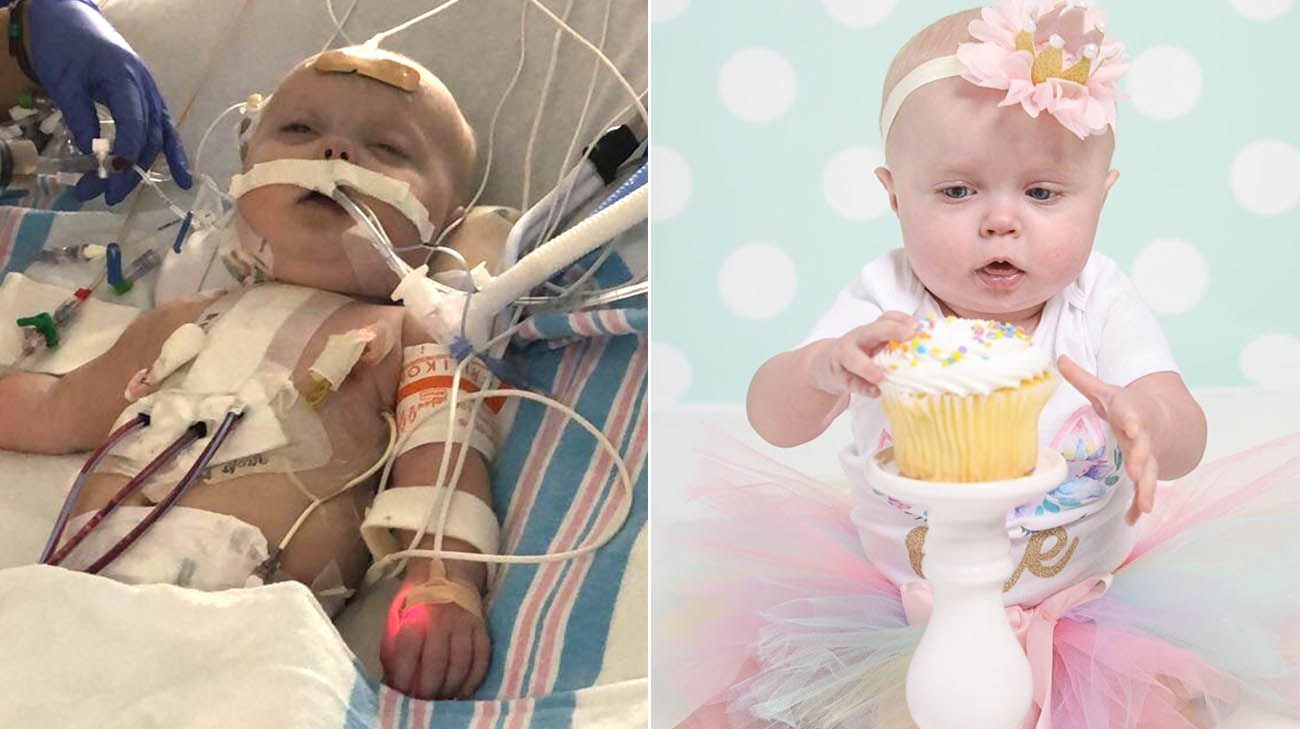 Paisley has come a long way in the first year of her life. (Courtesy: Natalie Bowers Photography )