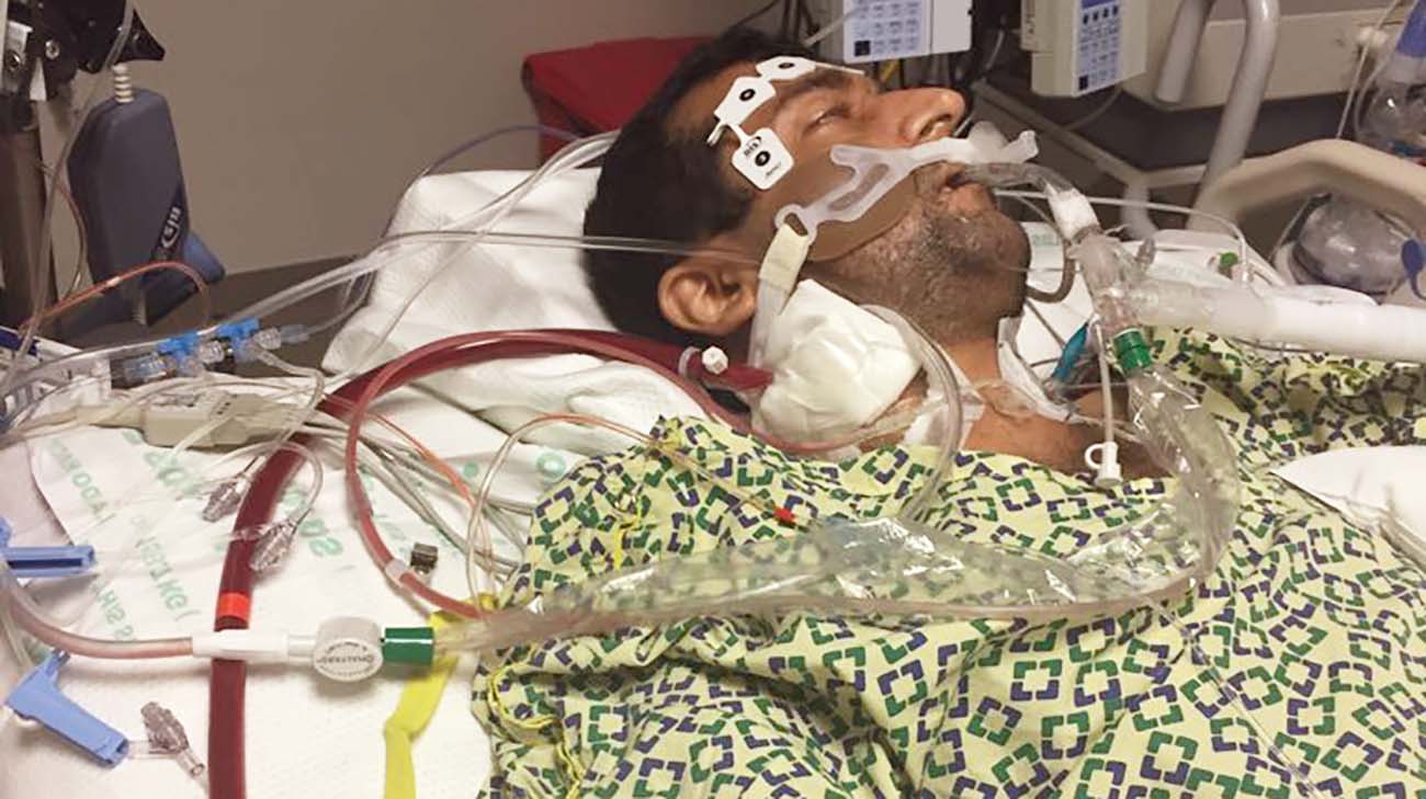 Cleveland Clinic doctors had to put Ajit Tolani on ECMO when his lungs couldn't work on their own. 