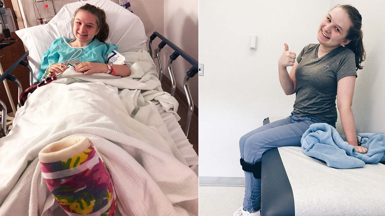 Erin Black underwent two foot reconstructions at Cleveland Clinic, the first in August 2017 and the second June 2018. (Courtesy: Erin Black)